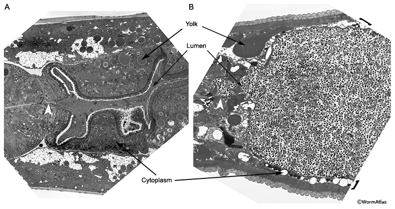 AIntFIG 3: Transmission electron micrographs (TEMs) of young and old C. elegans showing accumulation of bacteria in the intestine near the pharyngeal valve.